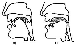 Figure 4.2 : voyelles antérieures (a) vs postérieures (b)